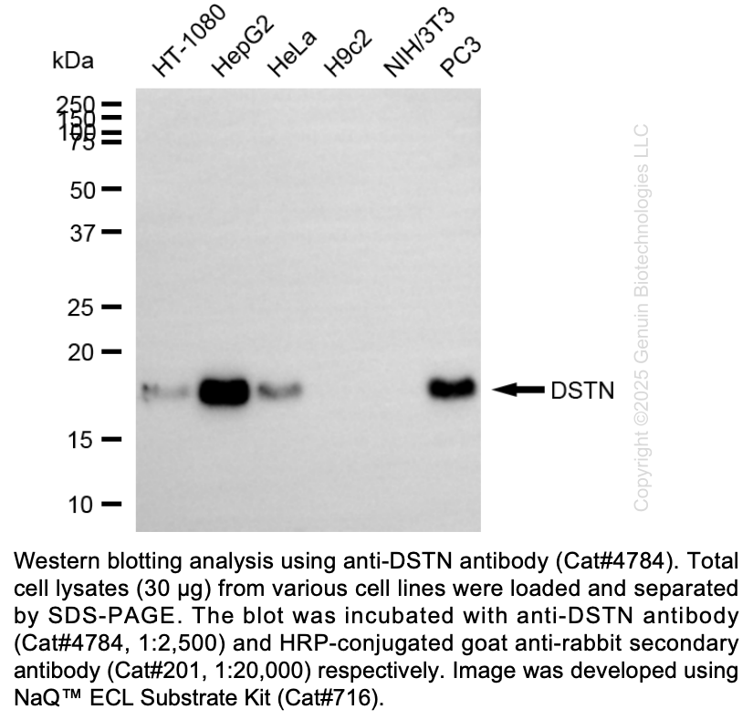 Anti-DSTN Mouse Monoclonal Ab #4784