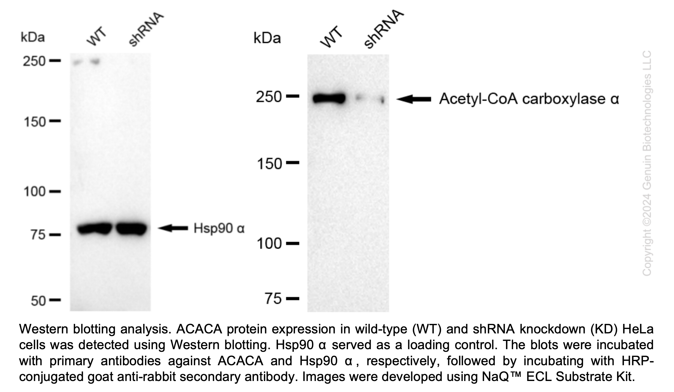 WB-Validated ACACA Lentiviral shRNA Knockdown Kit#V62029