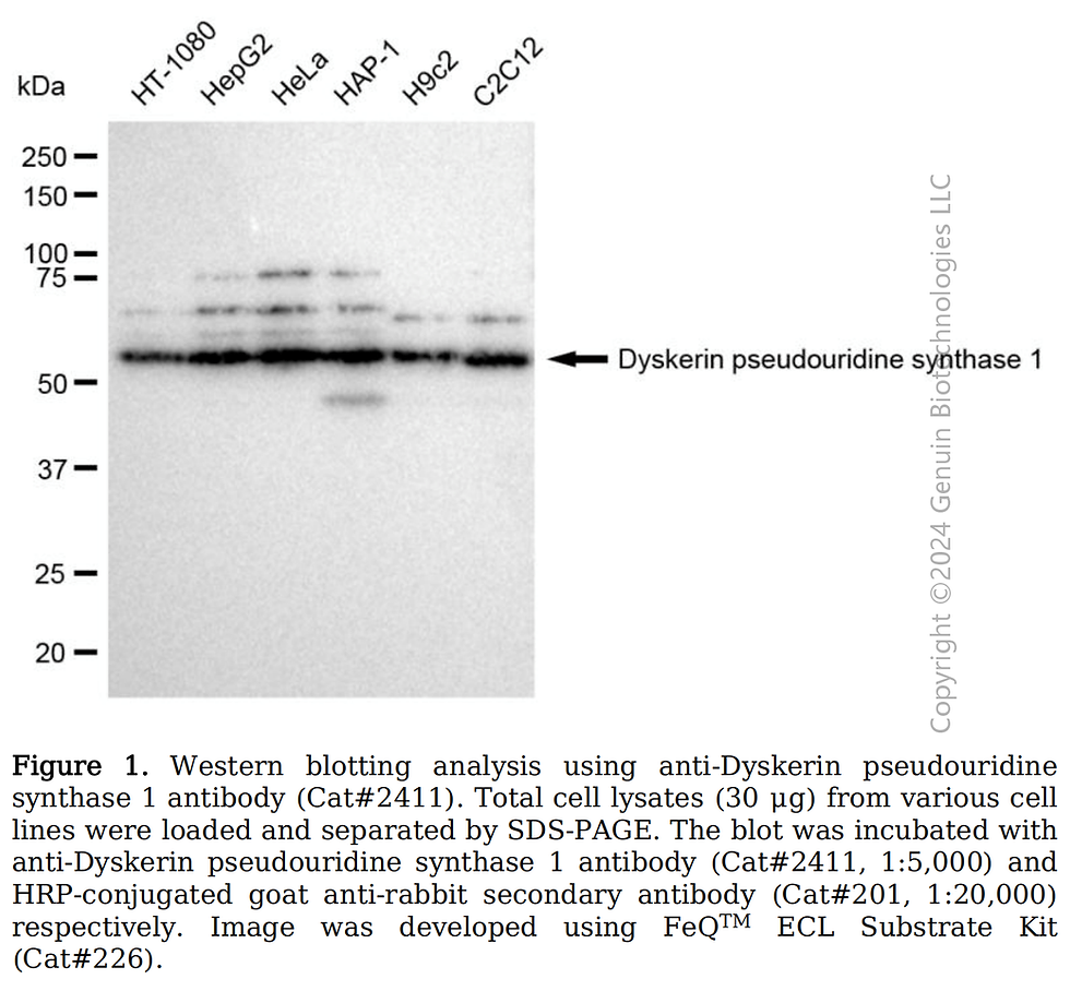 Thumbnail: Anti-Dyskerin pseudouridine synthase 1 Rabbit mAb #2411