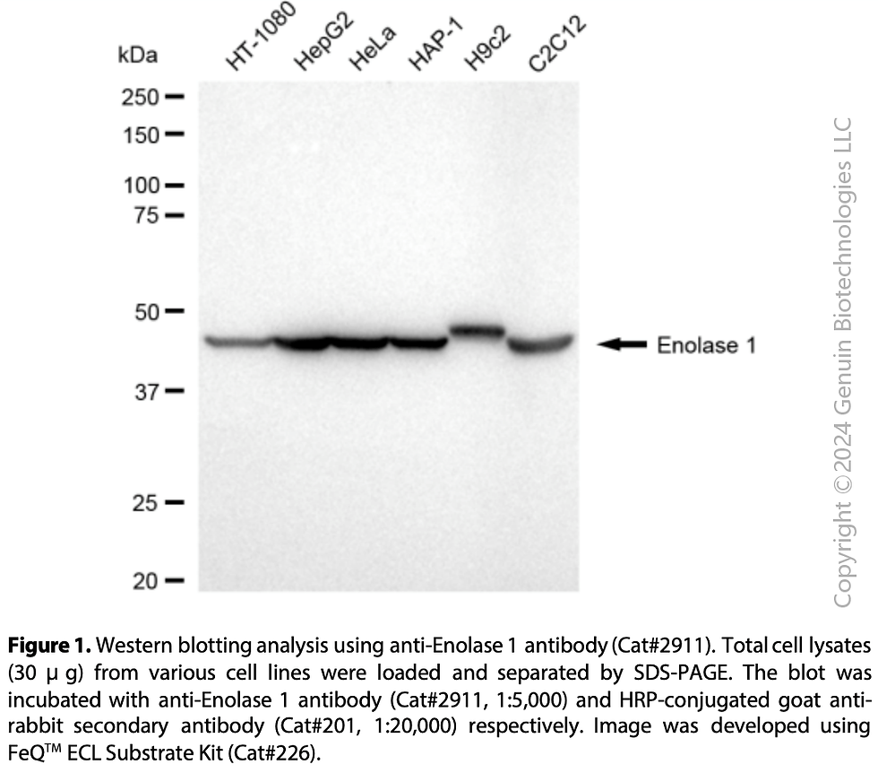 Thumbnail: Anti-Enolase 1 Rabbit mAb #2911