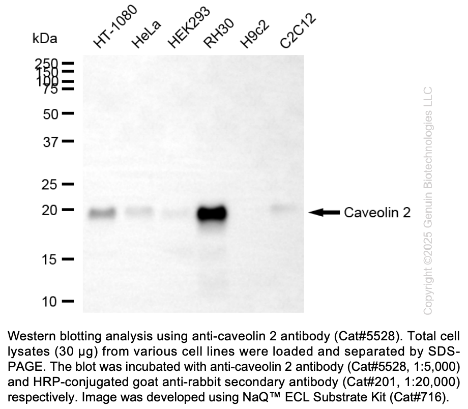 Anti-Caveolin 2 Rabbit mAb #5528