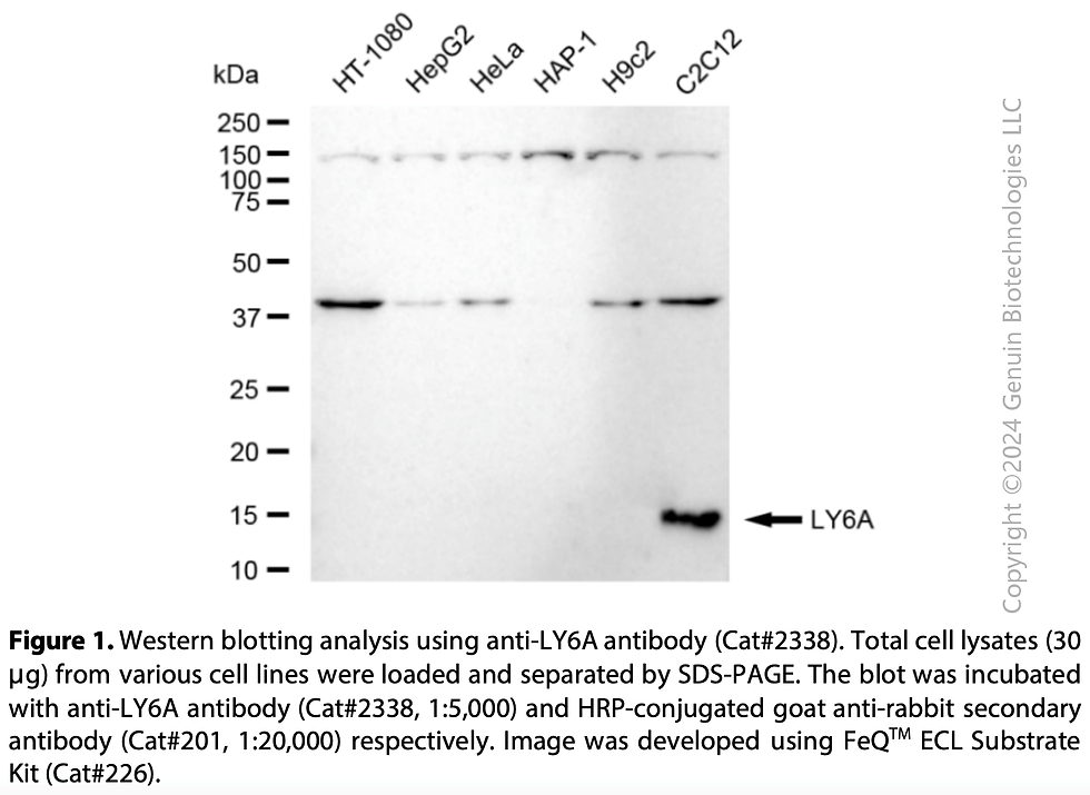 Thumbnail: Anti-Ly-6A.2/Ly-6E.1 Rabbit mAb #2338