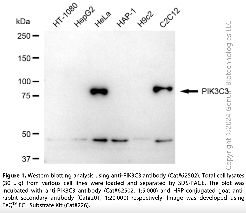 Thumbnail: KD-Validated Anti-PIK3C3 Rabbit Monoclonal Ab#62502