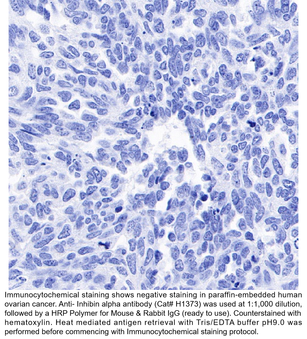 Anti-Inhibin alpha Rabbit Monoclonal Ab #H1373