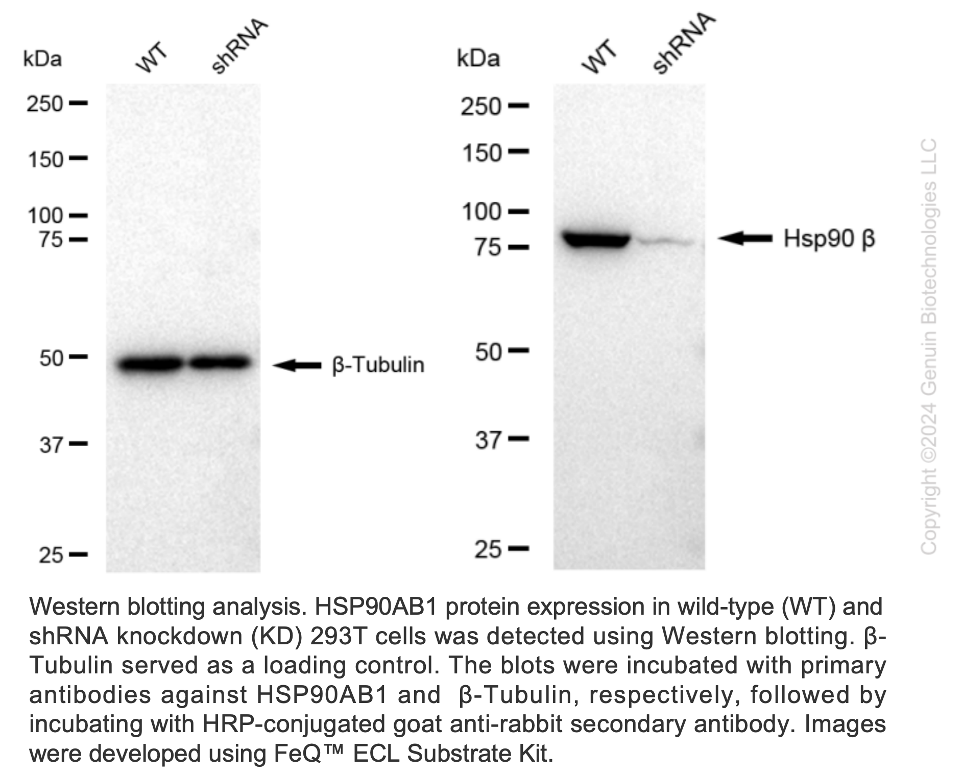 WB-Validated HSP90AB1 Lentiviral shRNA Knockdown Kit #V61472