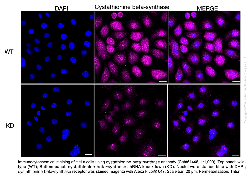 Thumbnail: KD-Validated Anti-Cystathionine Beta-Synthase Rabbit Monoclonal Ab#61446