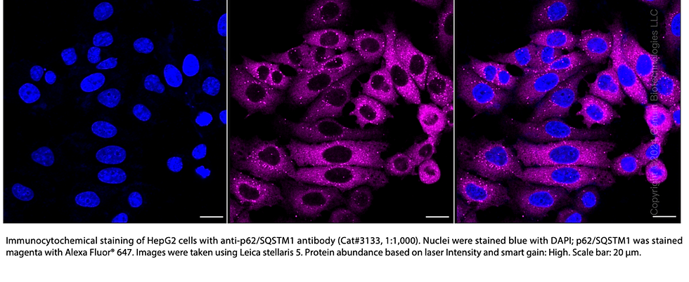Thumbnail: Anti-Sequestosome 1 Rabbit mAb #3133