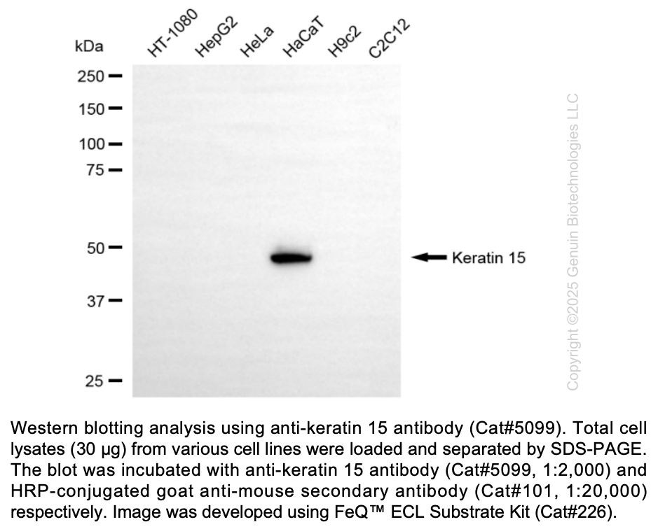 Anti-KRT15 Mouse Monoclonal Ab #5099