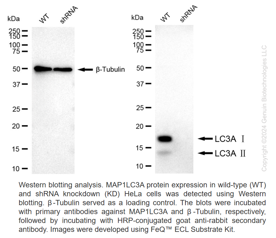 WB-Validated MAP1LC3A Knockdown Cell Lysate Kit#L61125