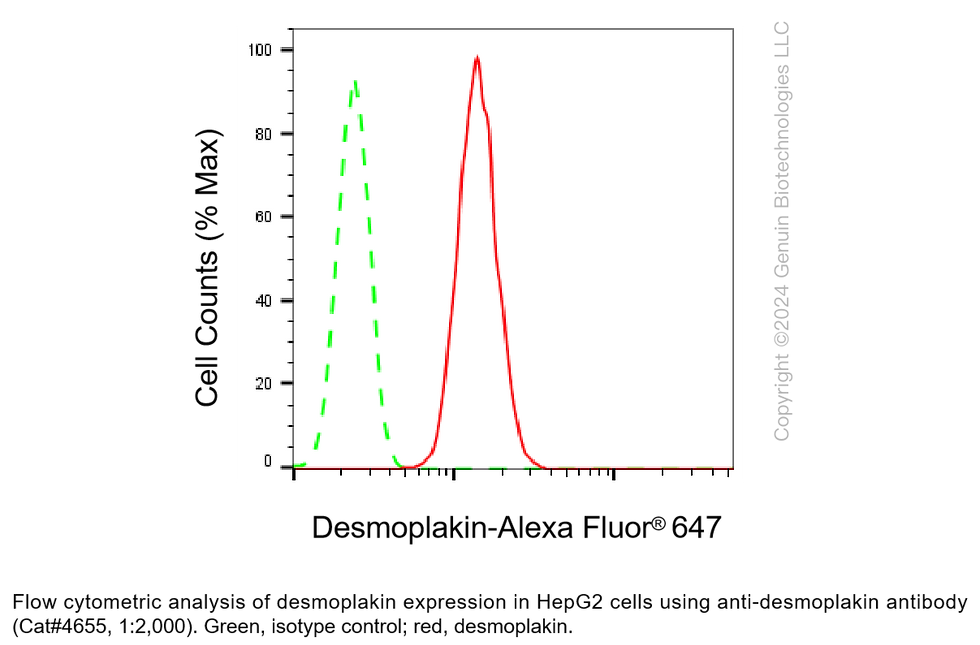 Thumbnail: Anti-Desmoplakin Rabbit Monoclonal Ab #4655