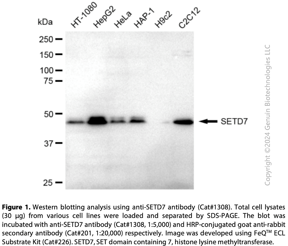 Thumbnail: Anti-SETD7 Rabbit mAb #1308
