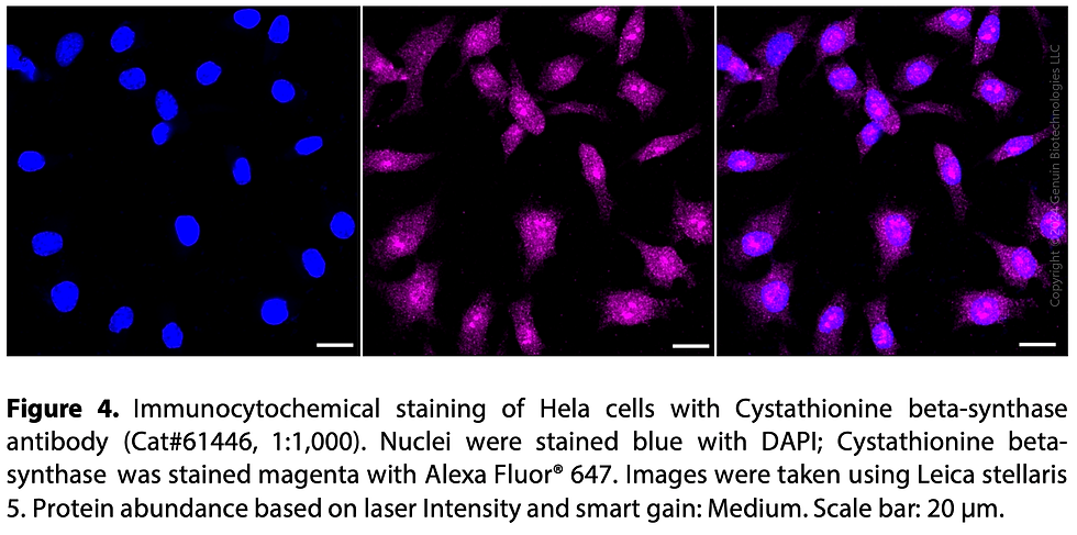 Thumbnail: KD-Validated Anti-Cystathionine Beta-Synthase Rabbit Monoclonal Ab#61446