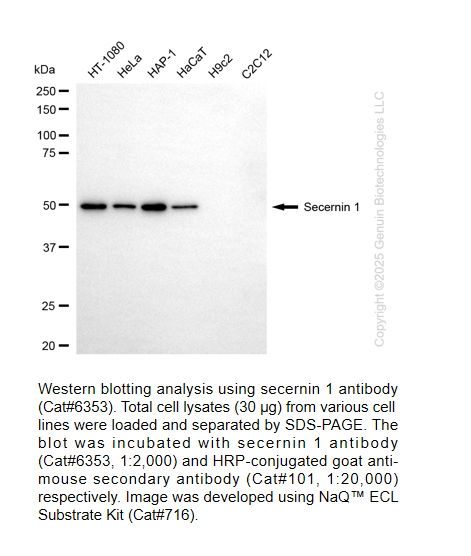 Secernin 1 Mouse mAb #6353