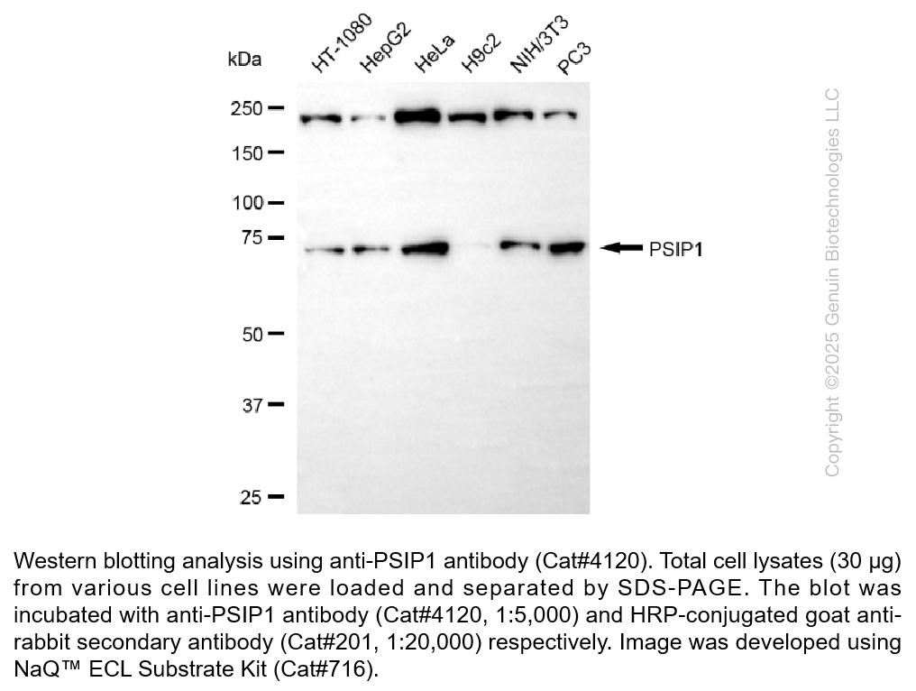 Anti-PSIP1 / LEDGF Rabbit Monoclonal Ab #4120