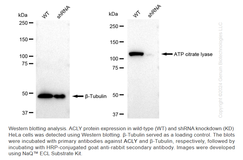 WB-Validated ACLY Knockdown Cell Lysate Kit#L61149