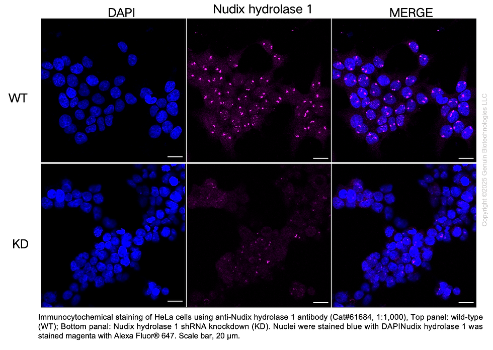 Thumbnail: KD-Validated Anti-Nudix Hydrolase 1 Rabbit Monoclonal Ab#61684