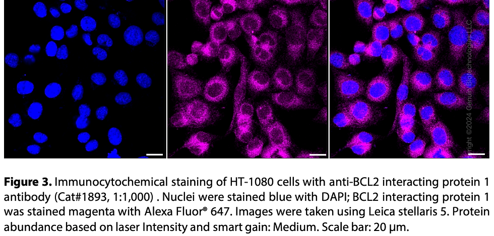 Thumbnail: Anti-BCL2 Interacting Protein 1 Rabbit mAb #1893