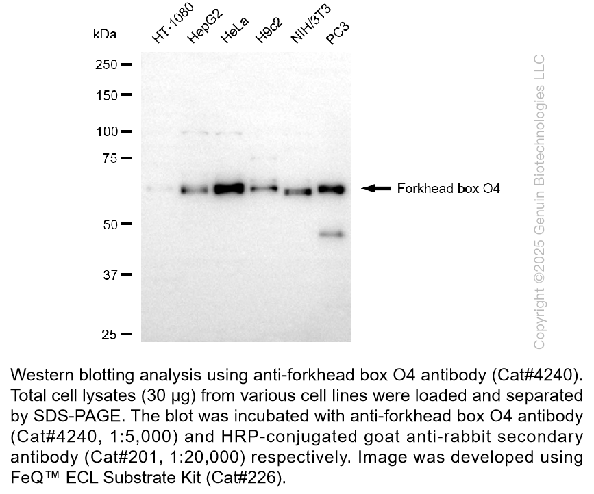 Anti-Forkhead Box O4 Rabbit Monoclonal Ab #4240