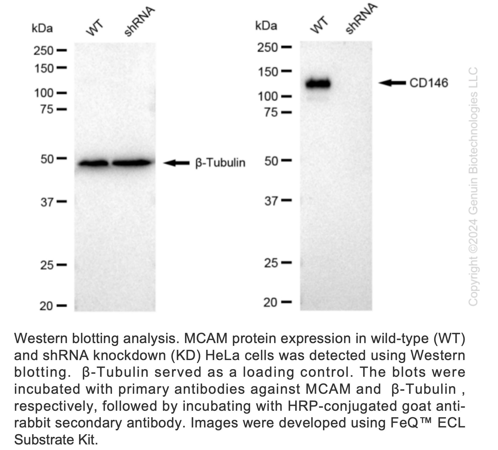 WB-Validated MCAM Knockdown Cell Lysate Kit#L61487