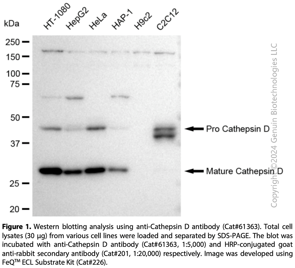 Thumbnail: KD-Validated Anti-Cathepsin D Rabbit Monoclonal Ab#61363