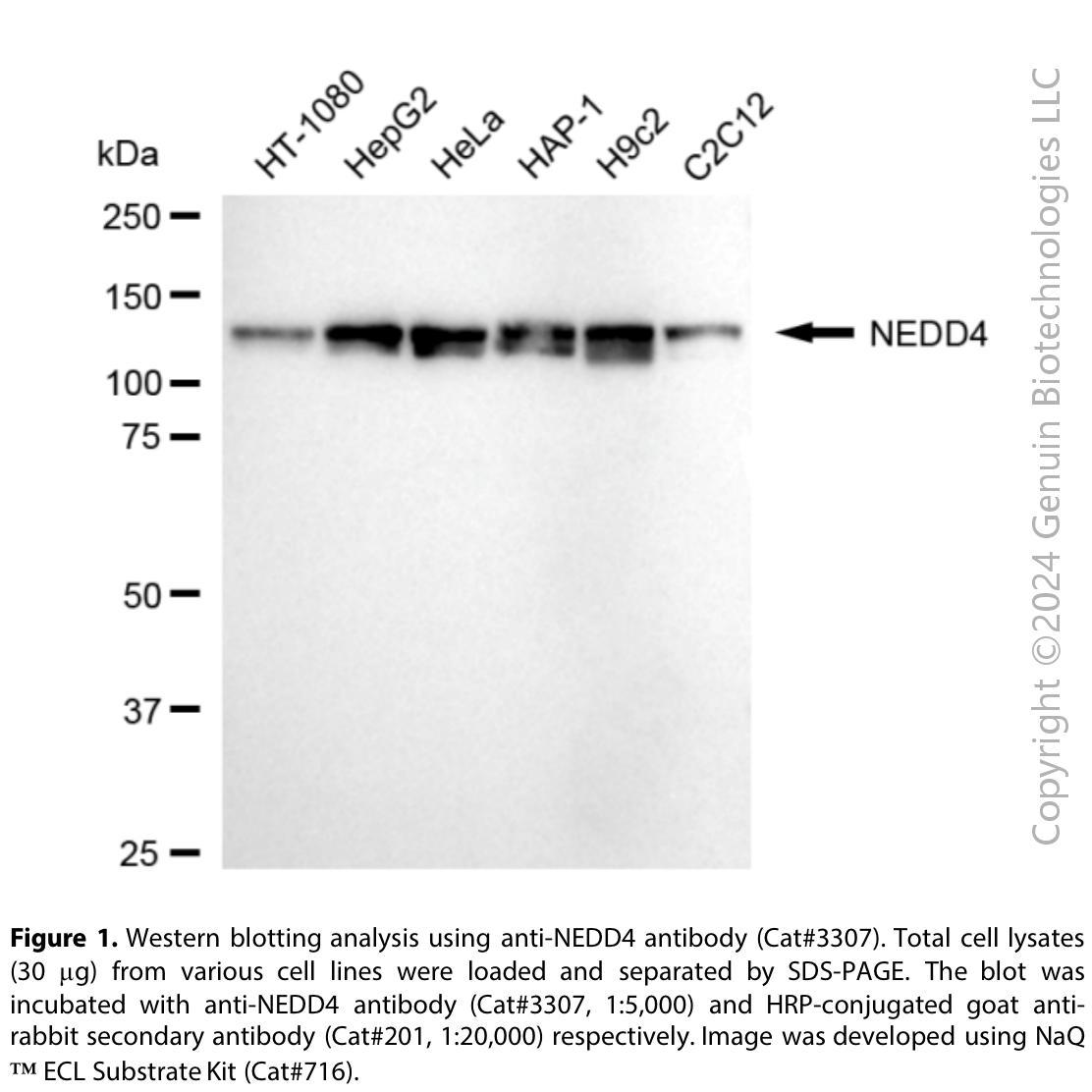 Anti-NEDD4 E3 Ubiquitin Protein Ligase Rabbit Monoclonal Ab#3307