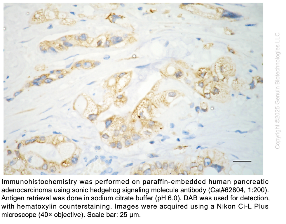 Thumbnail: KD-Validated Anti-Sonic Hedgehog Signaling Molecule Rabbit Monoclonal Ab#62804