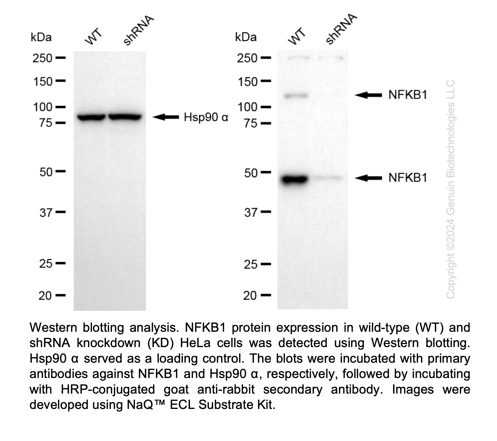 WB-Validated NFKB1 Lentiviral shRNA Knockdown Kit #V85241