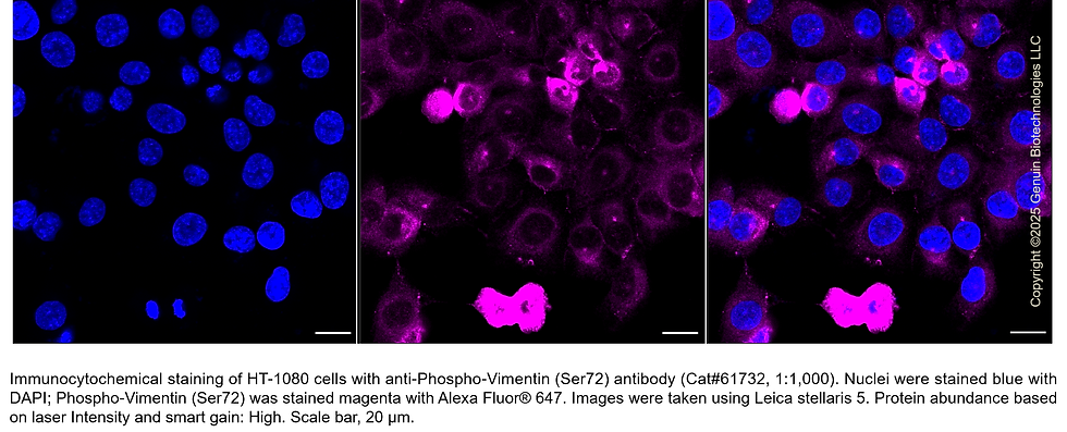 Thumbnail: KD-Validated Anti-Phospho-Vimentin (Ser72) Rabbit mAb #61732