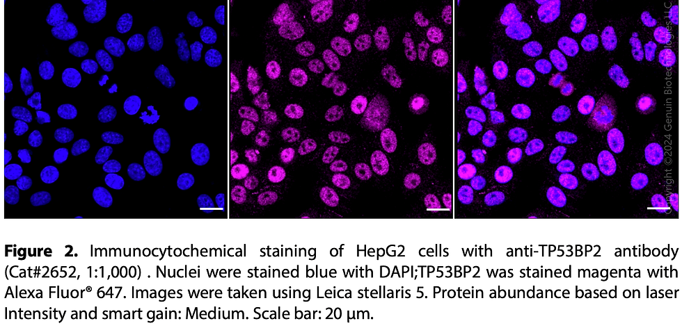 Thumbnail: Anti-Tumor Protein P53 Binding Protein 2 Rabbit mAb #2652