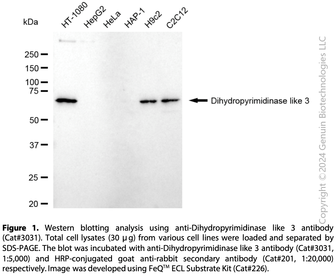 Anti-Dihydropyrimidinase Like 3 Rabbit mAb #3031