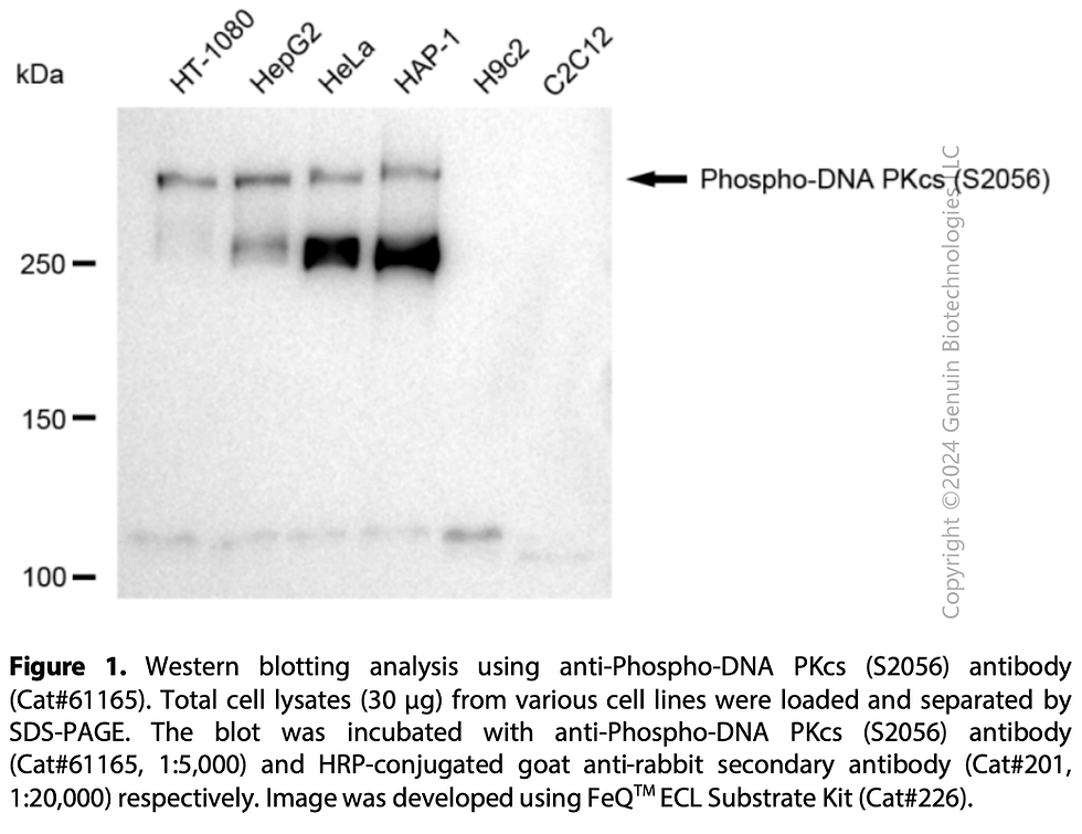 Thumbnail: KD-Validated Anti-Phospho-DNA PKcs (S2056) Rabbit mAb #61165