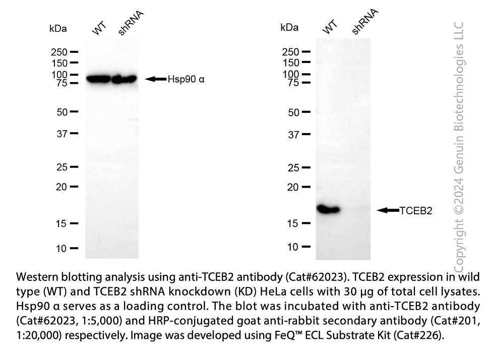 Thumbnail: KD-Validated Anti-TCEB2 Rabbit Monoclonal Antibody#62023