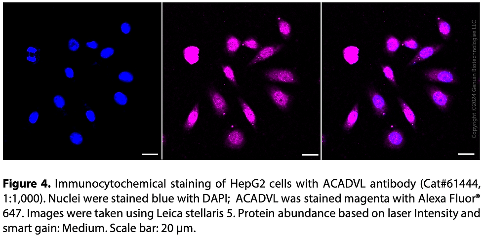 Thumbnail: KD-Validated Anti-ACADVL Rabbit Monoclonal Ab#61444