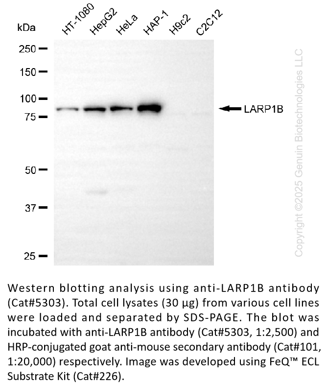 Anti-LARP1B Mouse Oligoclonal Ab #5303
