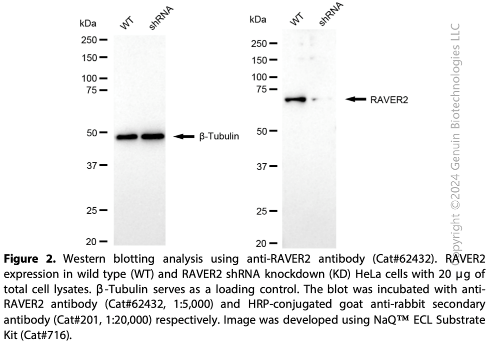 Thumbnail: KD-Validated Anti-RAVER2 Rabbit Monoclonal Ab #62432