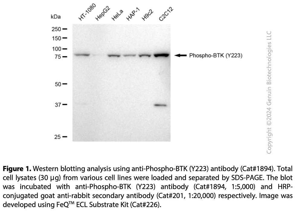 Anti-Phospho-BTK (Y223) Rabbit mAb #1894