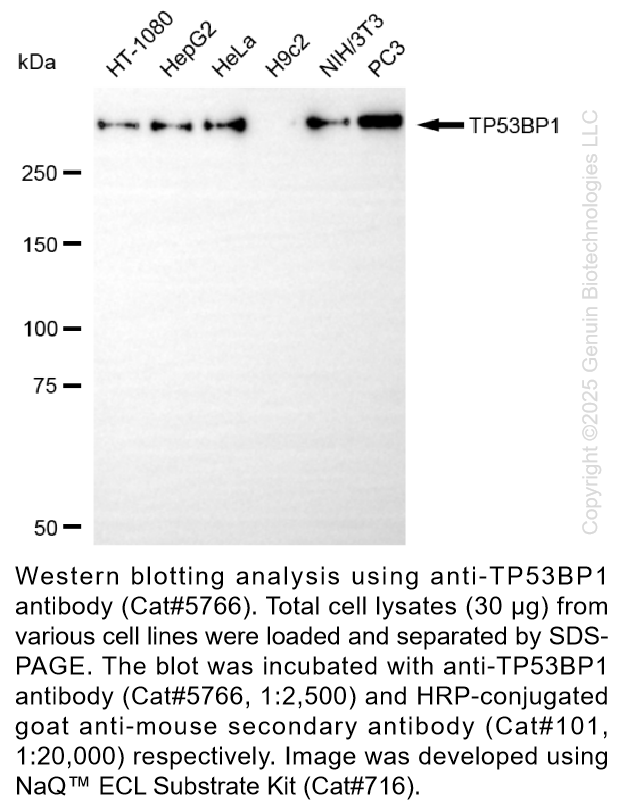 Anti-TP53BP1 Mouse Monoclonal Ab #5766