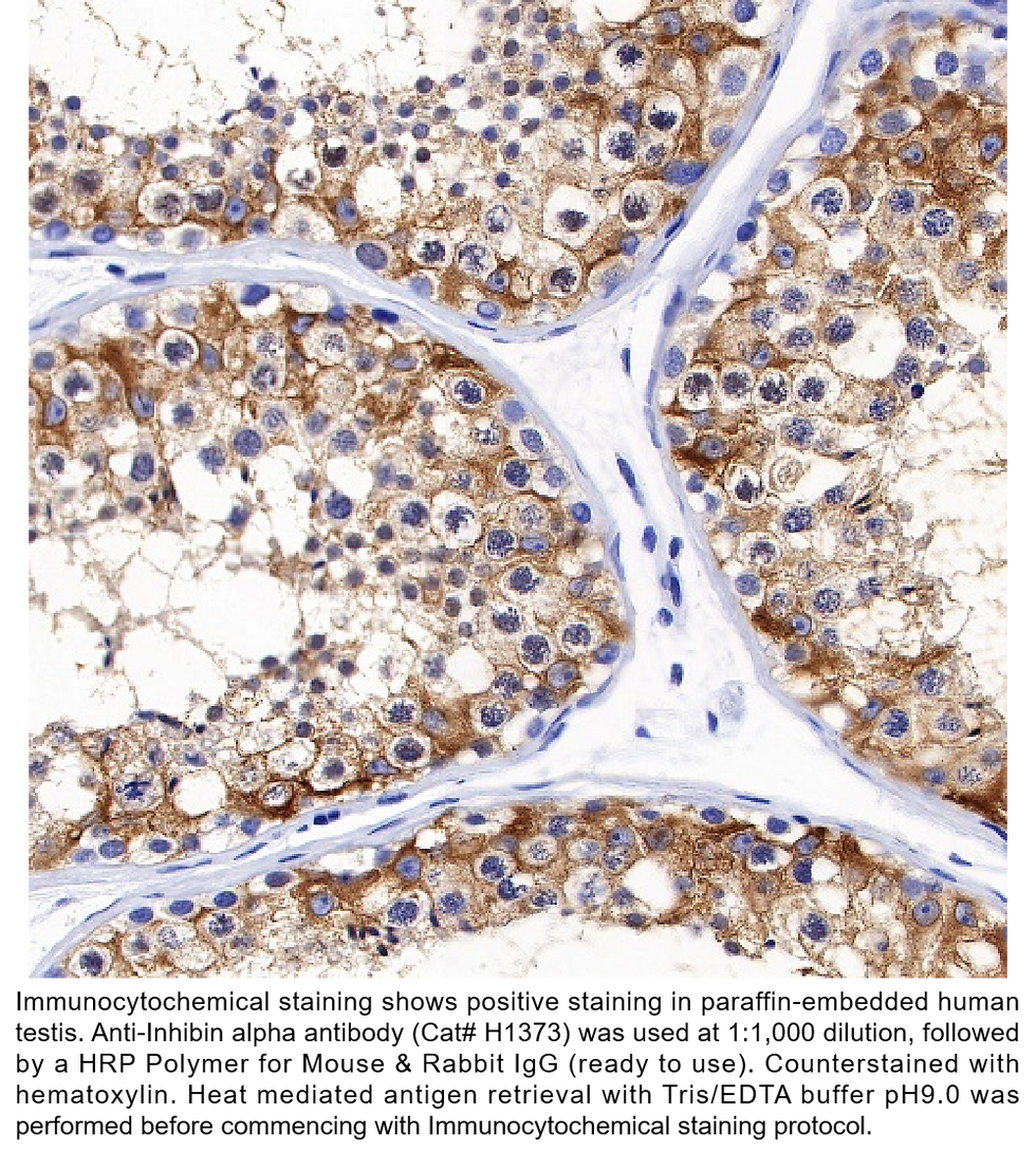 Thumbnail: Anti-Inhibin alpha Rabbit Monoclonal Ab #H1373