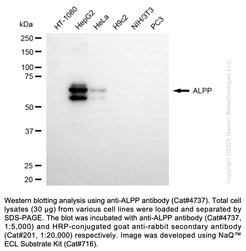 Anti-ALPP Rabbit Monoclonal Ab #4737
