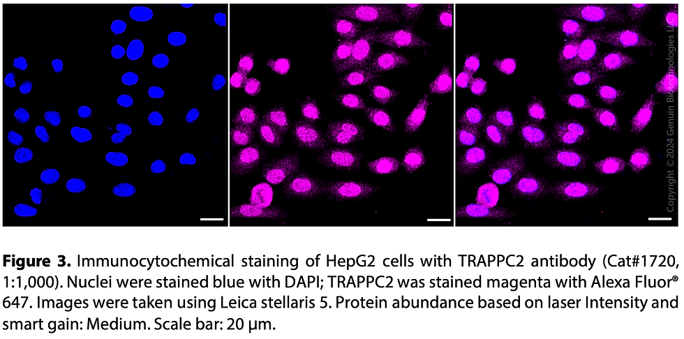 Thumbnail: Anti-TRAPPC2 Rabbit mAb #1720