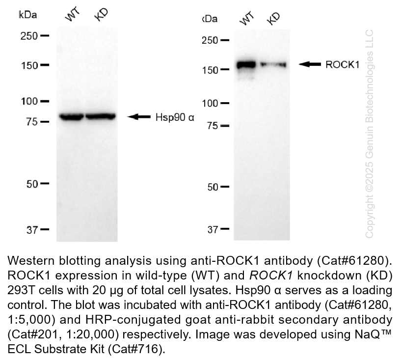 Thumbnail: KD-Validated Anti-ROCK1 Rabbit Monoclonal Ab #61280