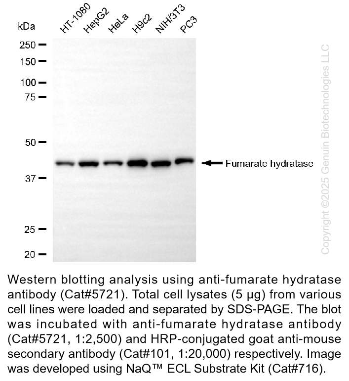 Anti-FumaRate HydRatase Mouse Monoclonal Ab #5721