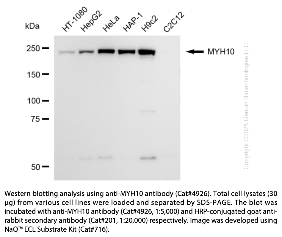 Anti-MYH10 Rabbit Monoclonal Ab #4926