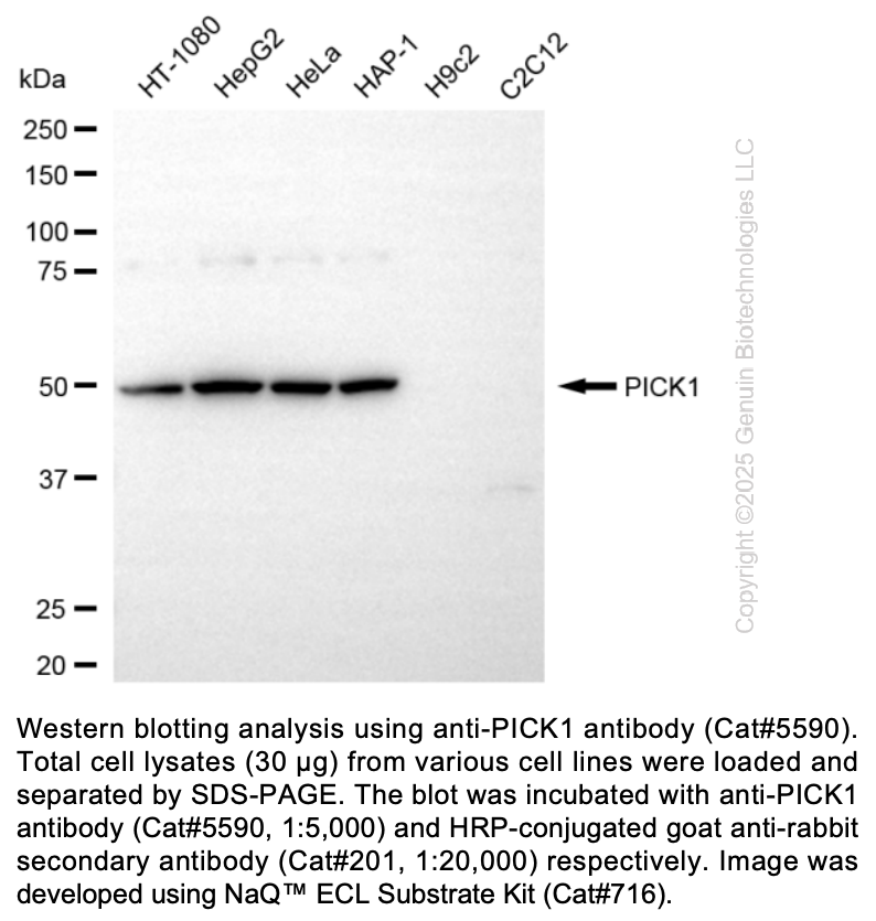 Anti-PICK1 Rabbit Monoclonal Ab #5590