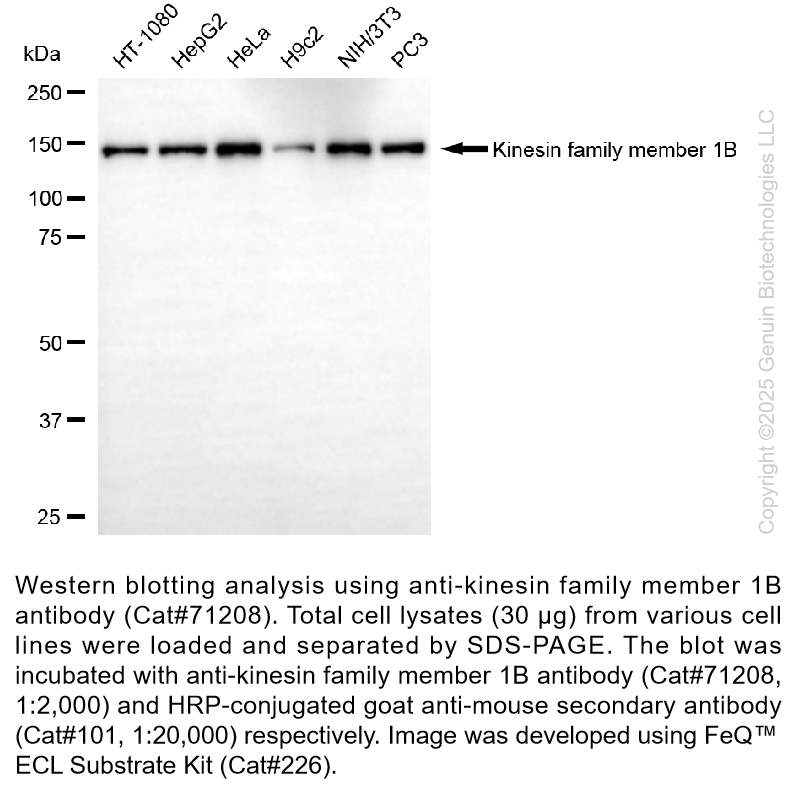 KO-Validated Anti-KIF1B Mouse mAb #71208