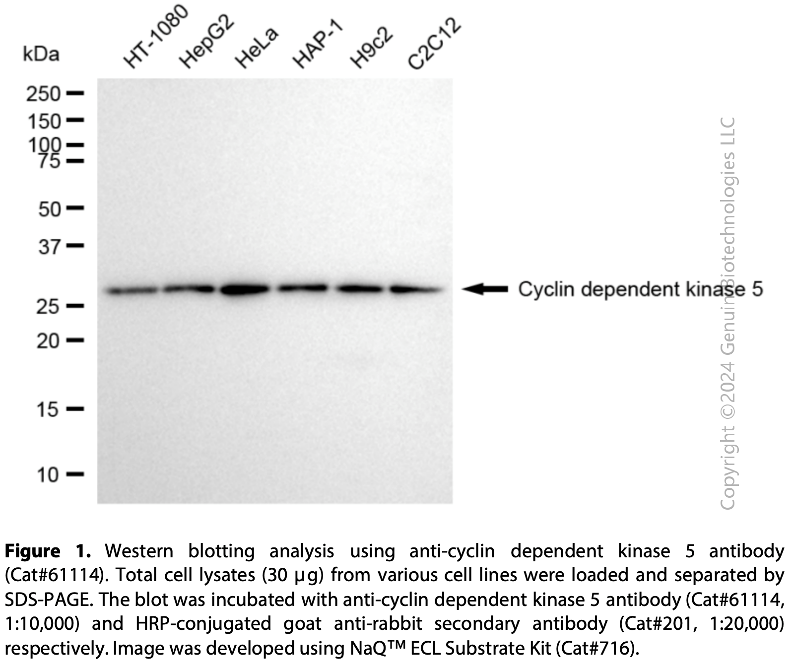 KD-Validated Anti-Cyclin Dependent Kinase 5 Rabbit mAb #61114