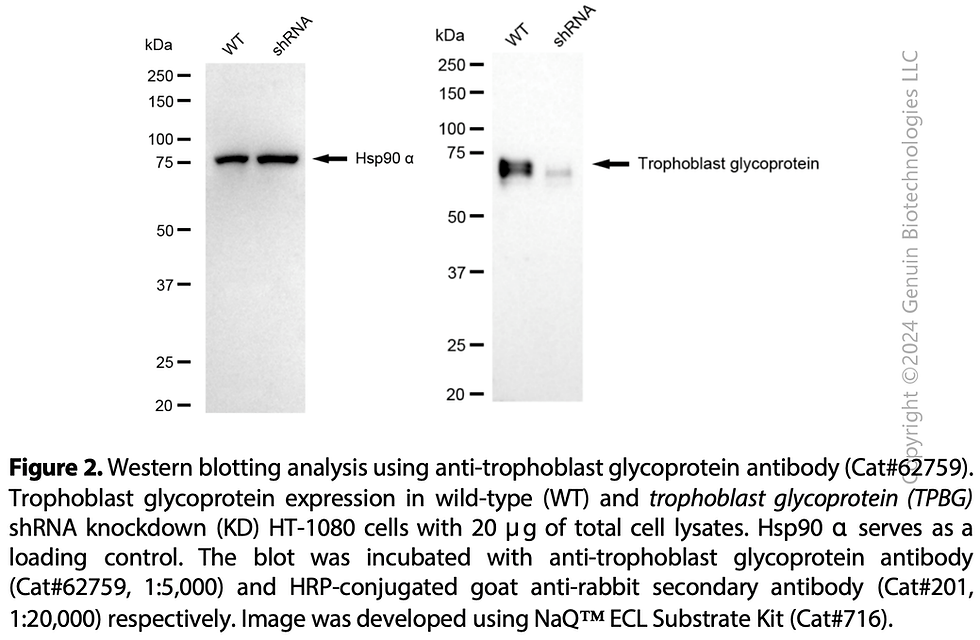 Thumbnail: KD-Validated Anti-Trophoblast Glycoprotein Rabbit Monoclonal Ab#62759