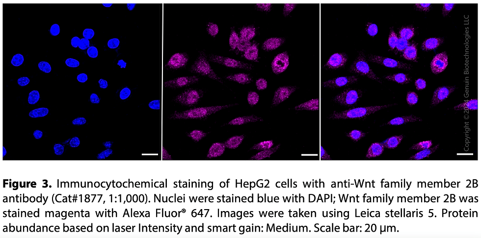 Thumbnail: Anti-Wnt Family Member 2B Rabbit mAb #1877