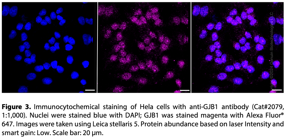 Thumbnail: Anti-GJB1 Rabbit mAb #2079