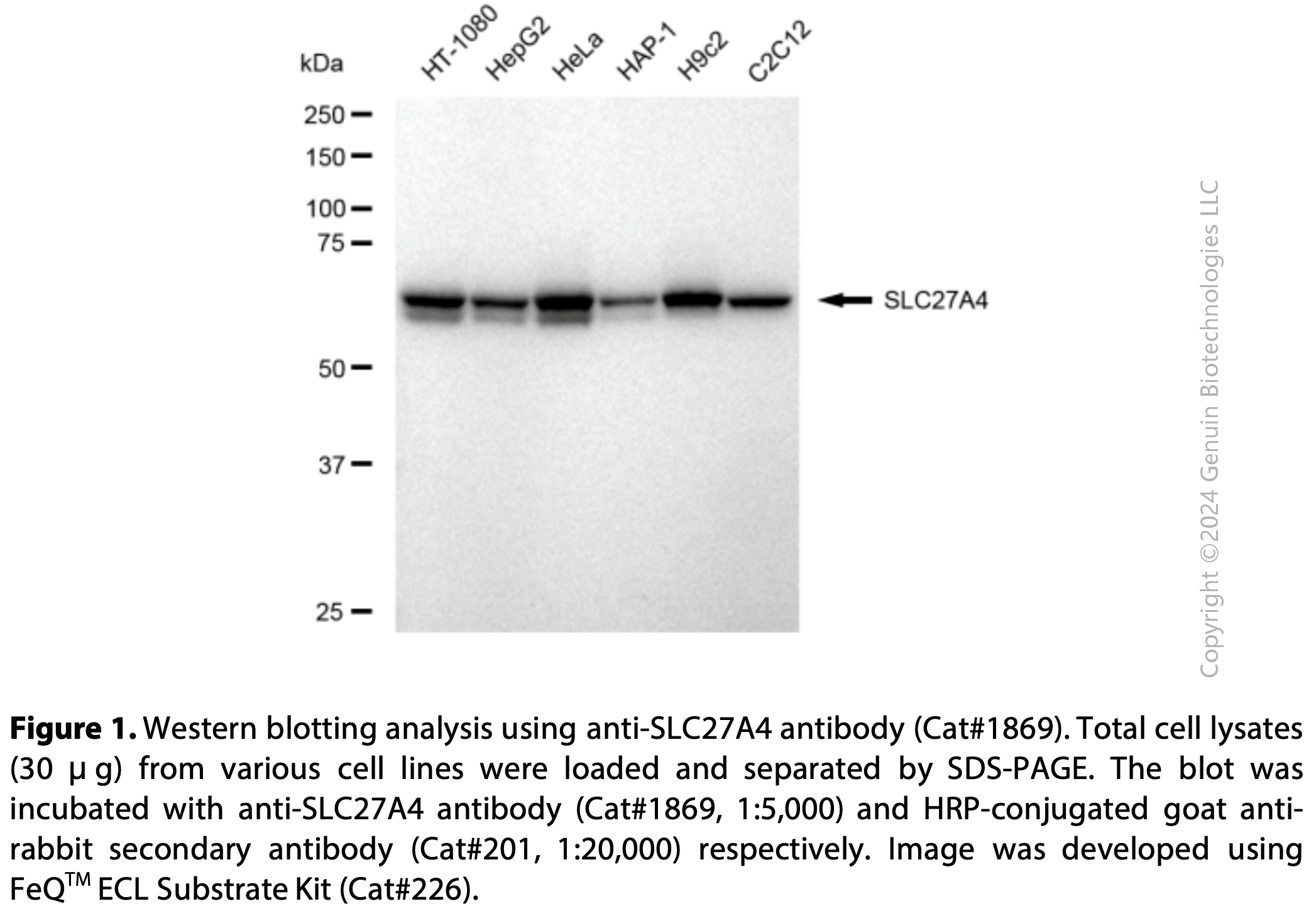 Anti-SLC27A4 Rabbit mAb #1869